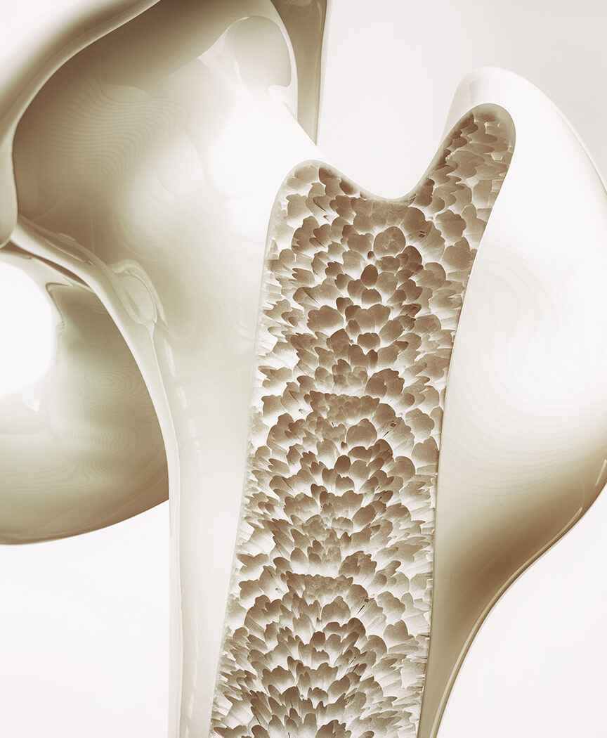 骨粗鬆症のイメージ